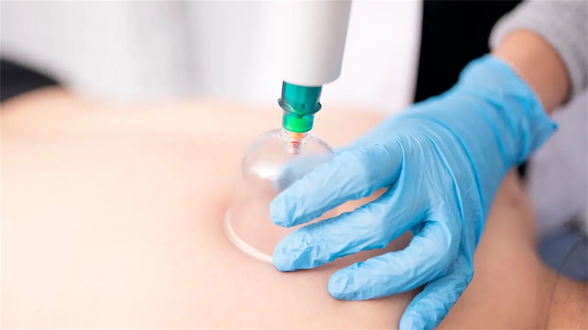 Hacamat Hizmeti - Koza Evde Sağlık Hizmetleri