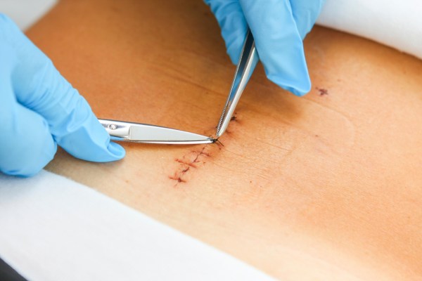 Evde Profesyonel Dikiş Alma Hizmeti - Koza Evde Sağlık